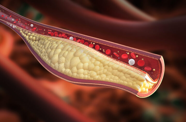 Preclinical Study Shows Safety, Efficacy, and Durability of Lowering LDL-Cholesterol Levels Long-Term in Non-Human Primates