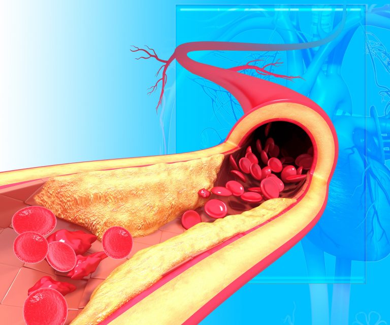 Cellular Housekeeping Process May Protect against Atherosclerosis