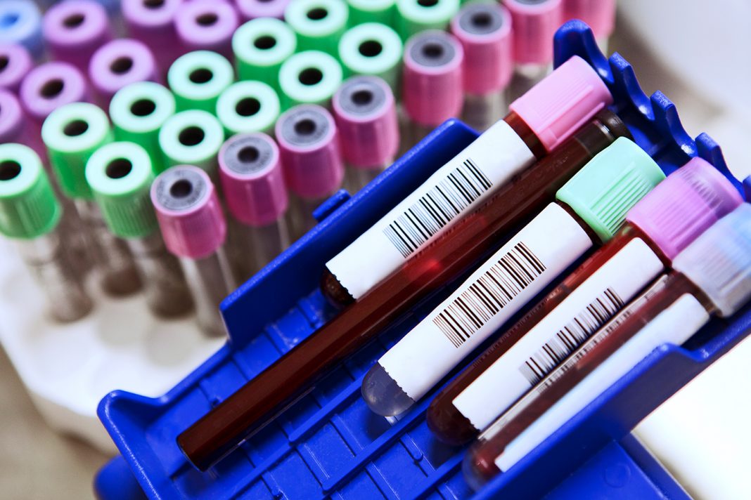 blood test tubes