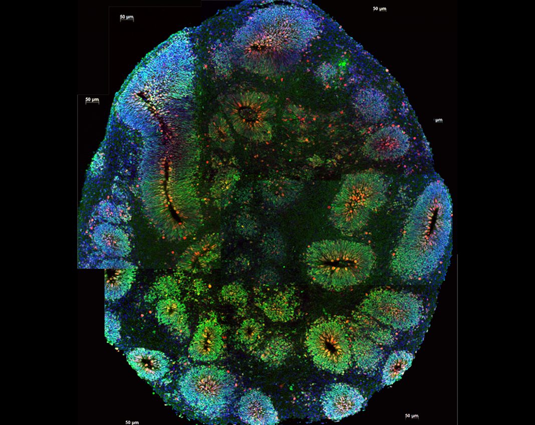 Brain Organoid