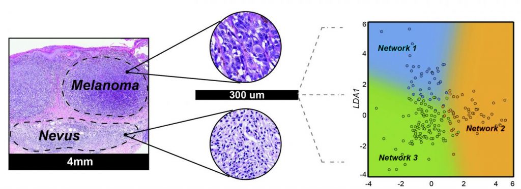 Using miRNA biomarkers to diagnose melanoma