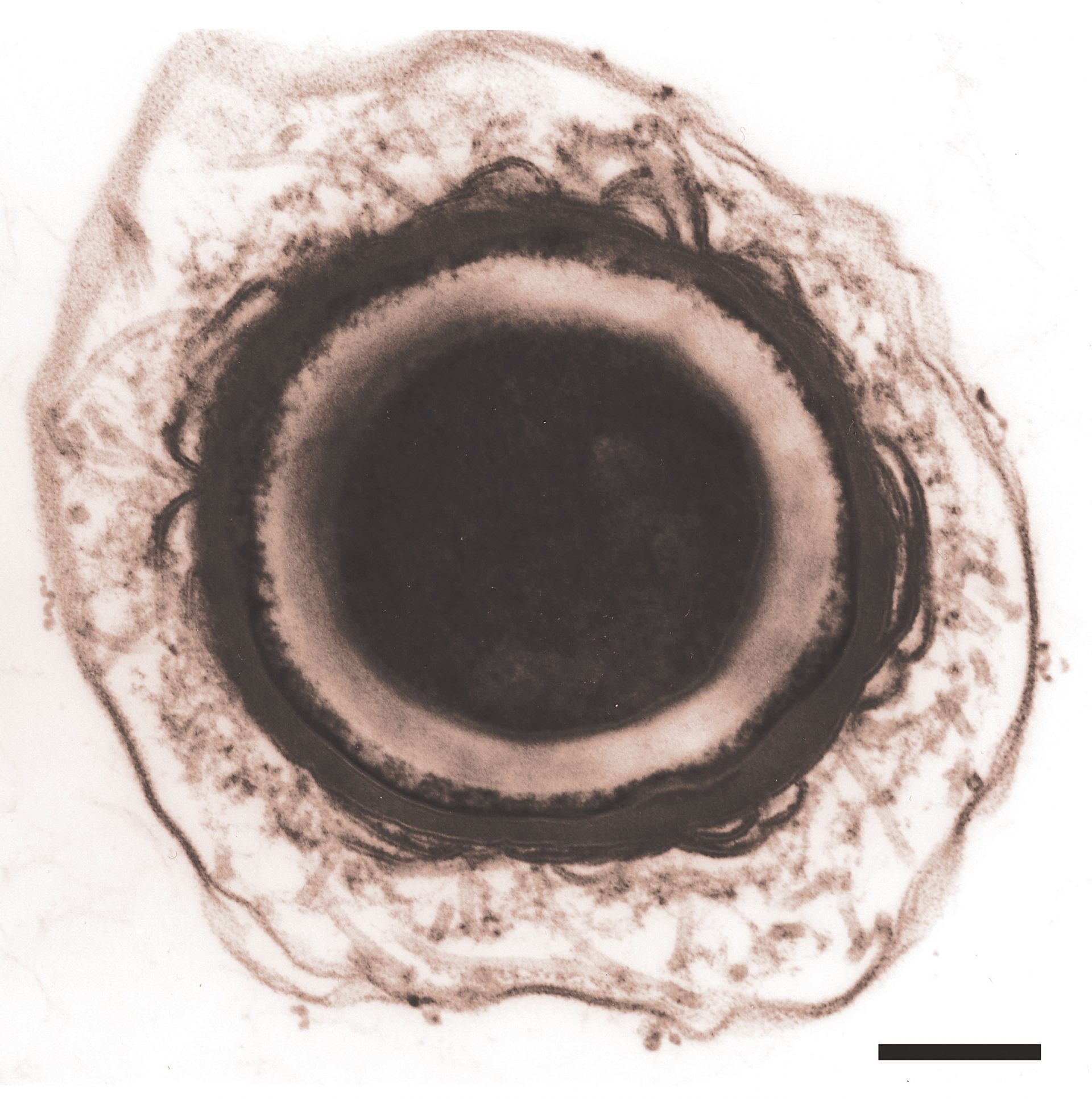 Через образовавшееся отверстие. Ботулизм под микроскопом. Clostridium botulinum фото. Spores of bacteria.