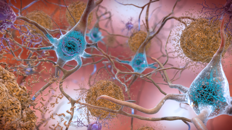 Alzheimer’s Pathology Could Benefit from Activating Microglial Targets of Rapamycin