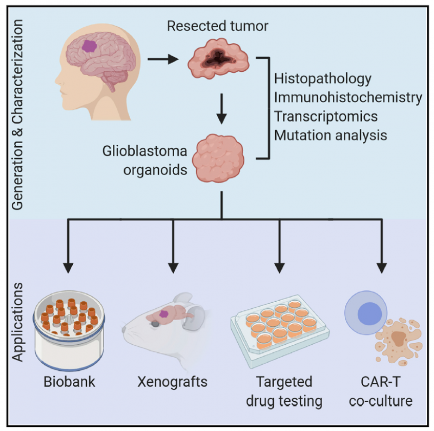 Improved Glioblastoma Treatments Could Lie in Tumor Organoids