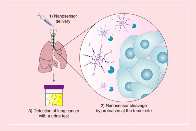 nanoparticles to detect lung cancer