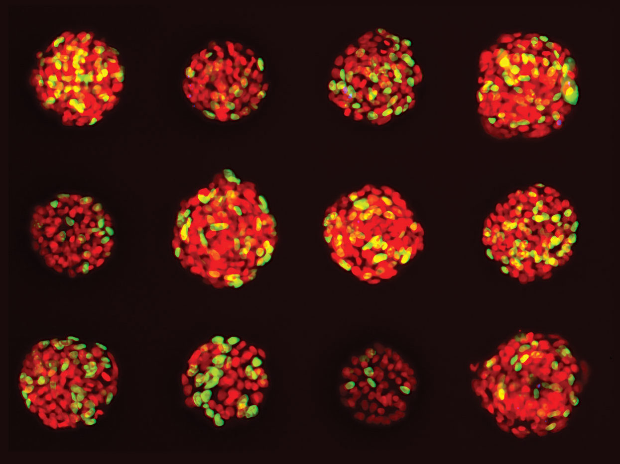 Cancer spheroids