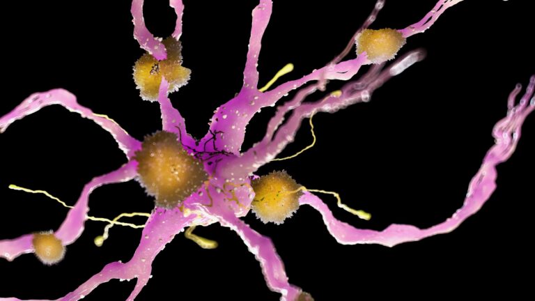 Lecanemab Approval for Early Alzheimer’s Disease Hits Roadblock in Europe