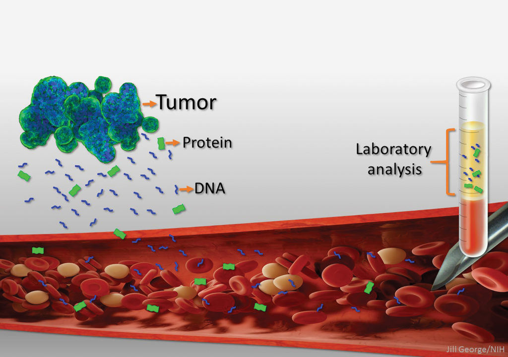 liquid biopsies are the molecular fragments shed by tumors