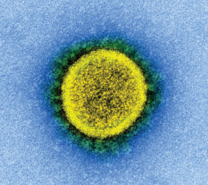 A SARS-CoV-2 viral particle