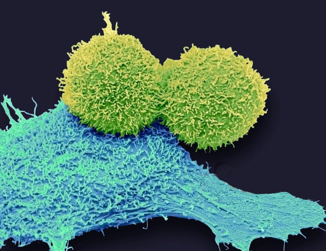 Breast Cancer Cells