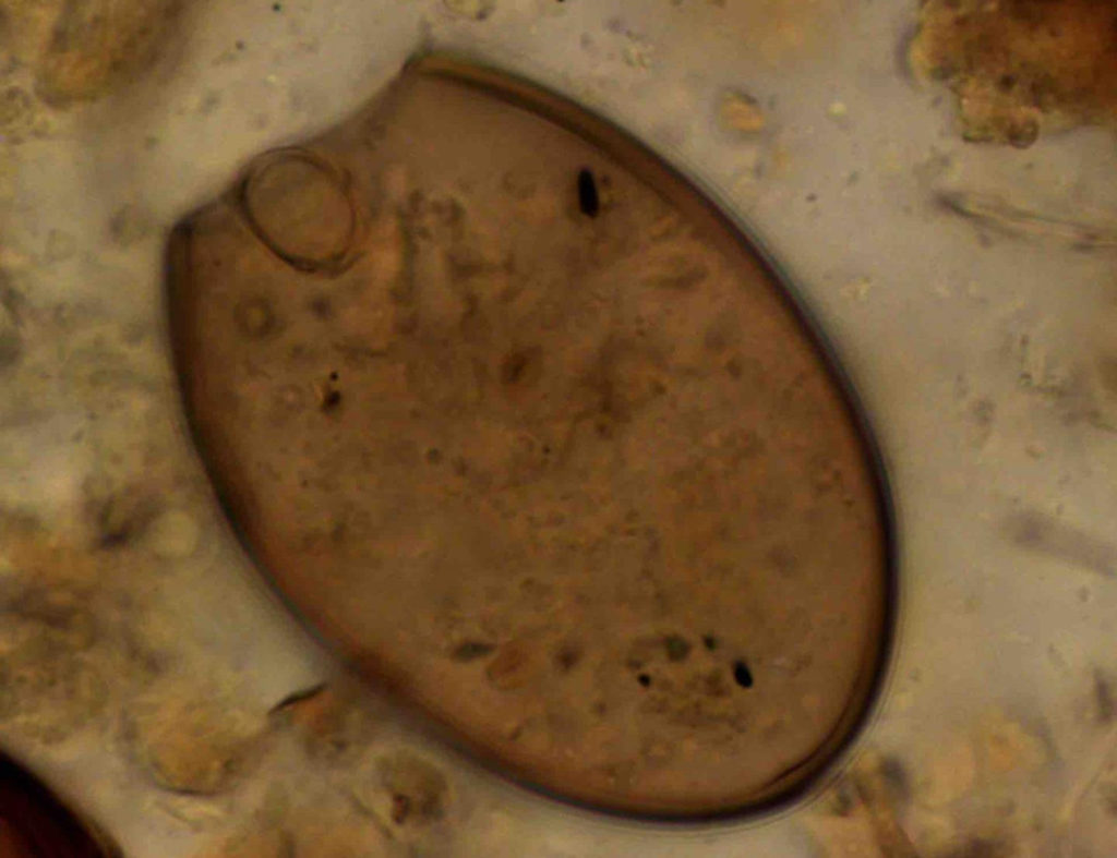 Microscopic Fish Tapeworm Egg from the Medieval Latrine at Riga