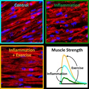 Exercise blocks inflammation in muscles