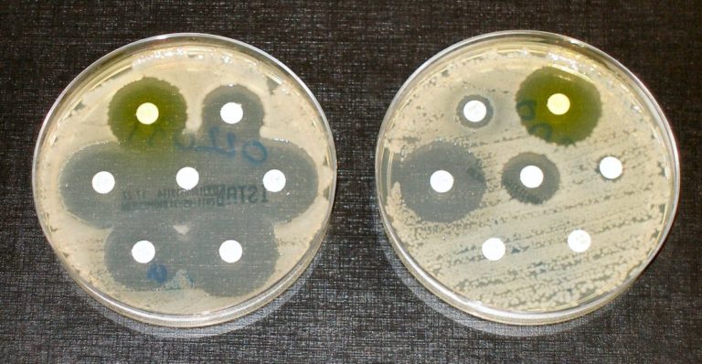 Antimicrobial Resistance Genes Spread via Few Dominant Lineages