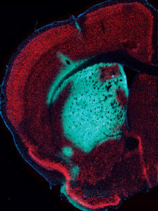 cerebellum of a wild-type mouse