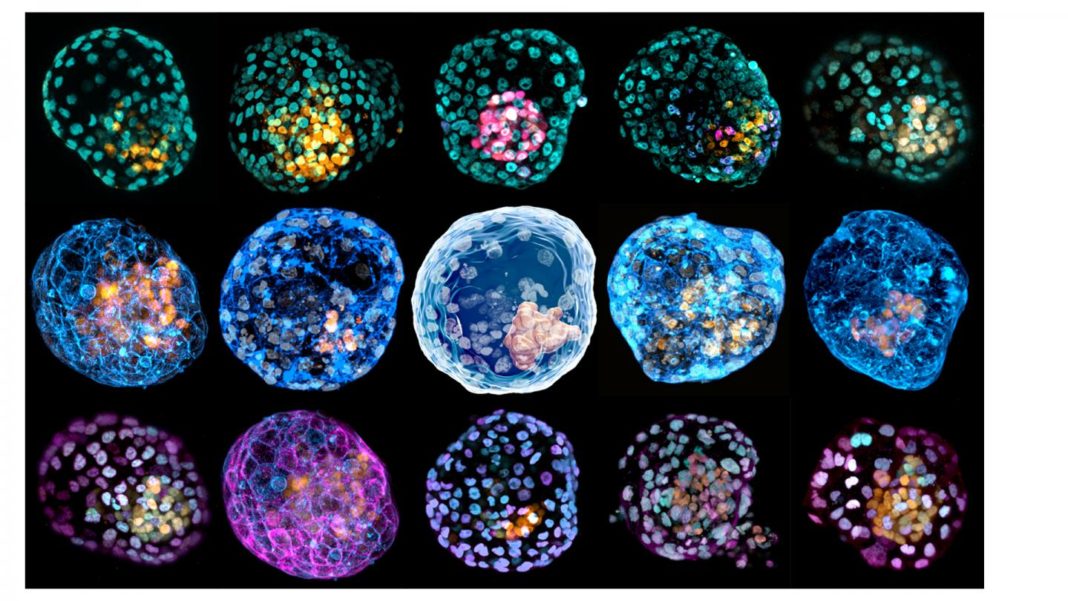 Model Of Human Embryo Fashioned From Reprogrammed Skin Cells