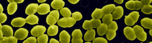 Enterococcus faecalis 