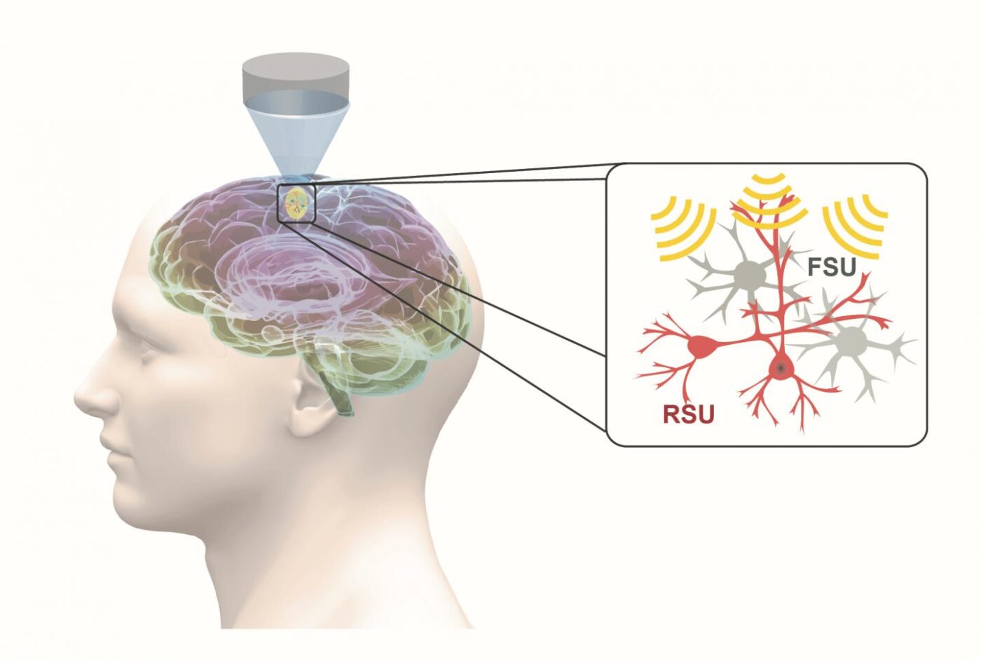 ultrasound-offers-focused-noninvasive-option-for-neuropsychiatric-disorders