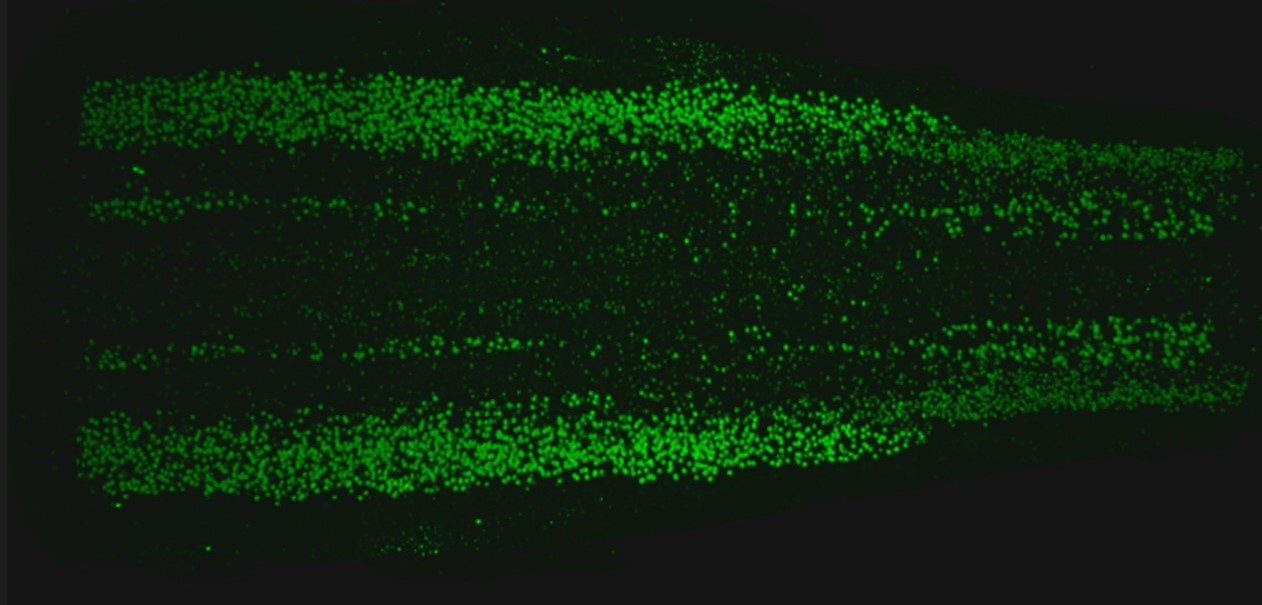 unexpected-rich-diversity-in-neurons-that-control-movement-nih-study-reveals-laptrinhx-news