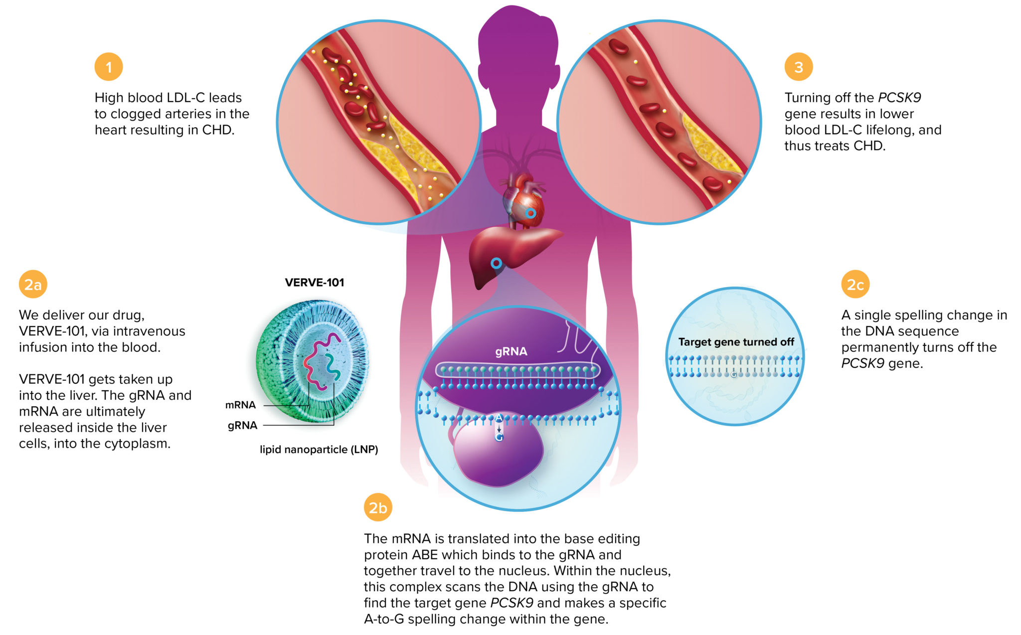 Base editing. Pcsk9 препараты. GRNA. Ген 9p13. Nucleoplasty: Therapeutics.