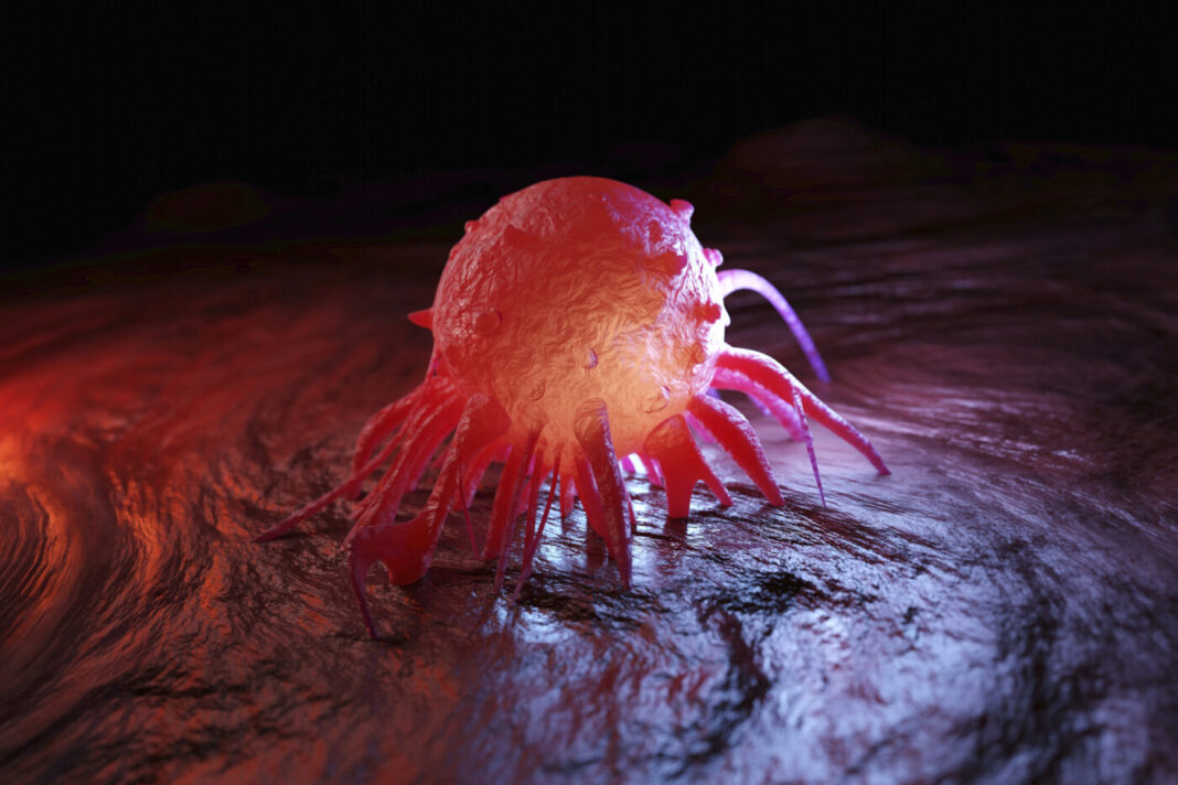 3D Illustration of cancer cell in human body