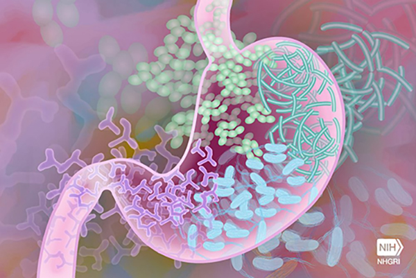 Metabolite Identification in Metabolomics