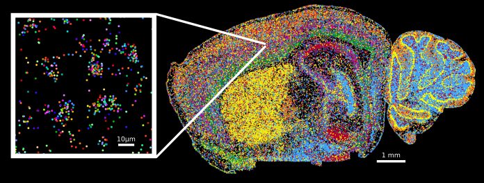 Pattern in Brain