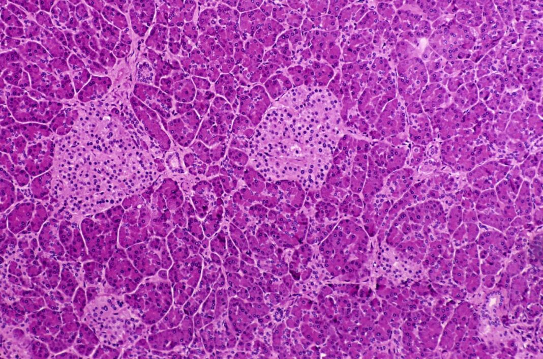 Light micrograph of human pancreas. Islands of Langerhans, Acinar Cells, and Ducts, 25x at 35mm. Shows endocrine tissue (ductless), and exocrine tissue (acinar cells with ducts).