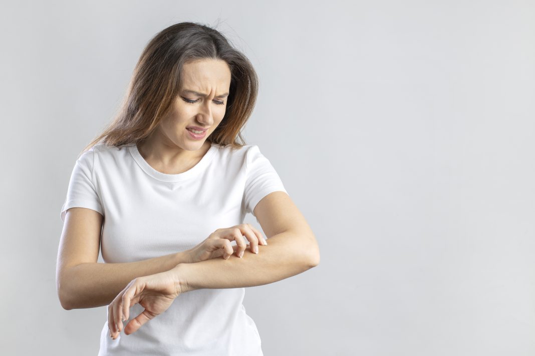 Young woman scratching her itchy arm