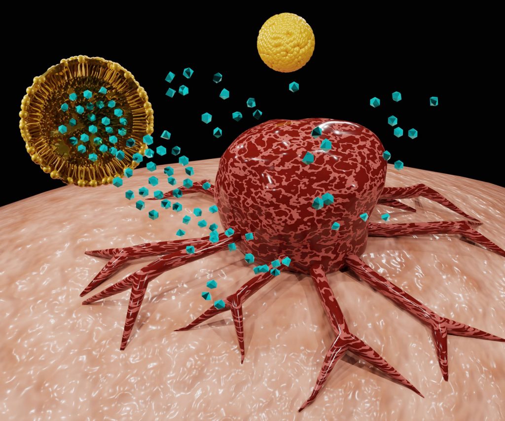 Lipid-based nanocarriers may be used to deliver cancer therapeutics
