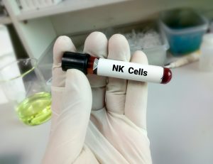 Blood sample for Natural killer cells or NK cells, are a type of lymphocyte (a white blood cell) and a component of innate immune system.