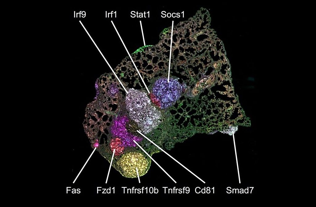 Spatial mapping of Pro-Code/CRISPR lung tumor lesions. 