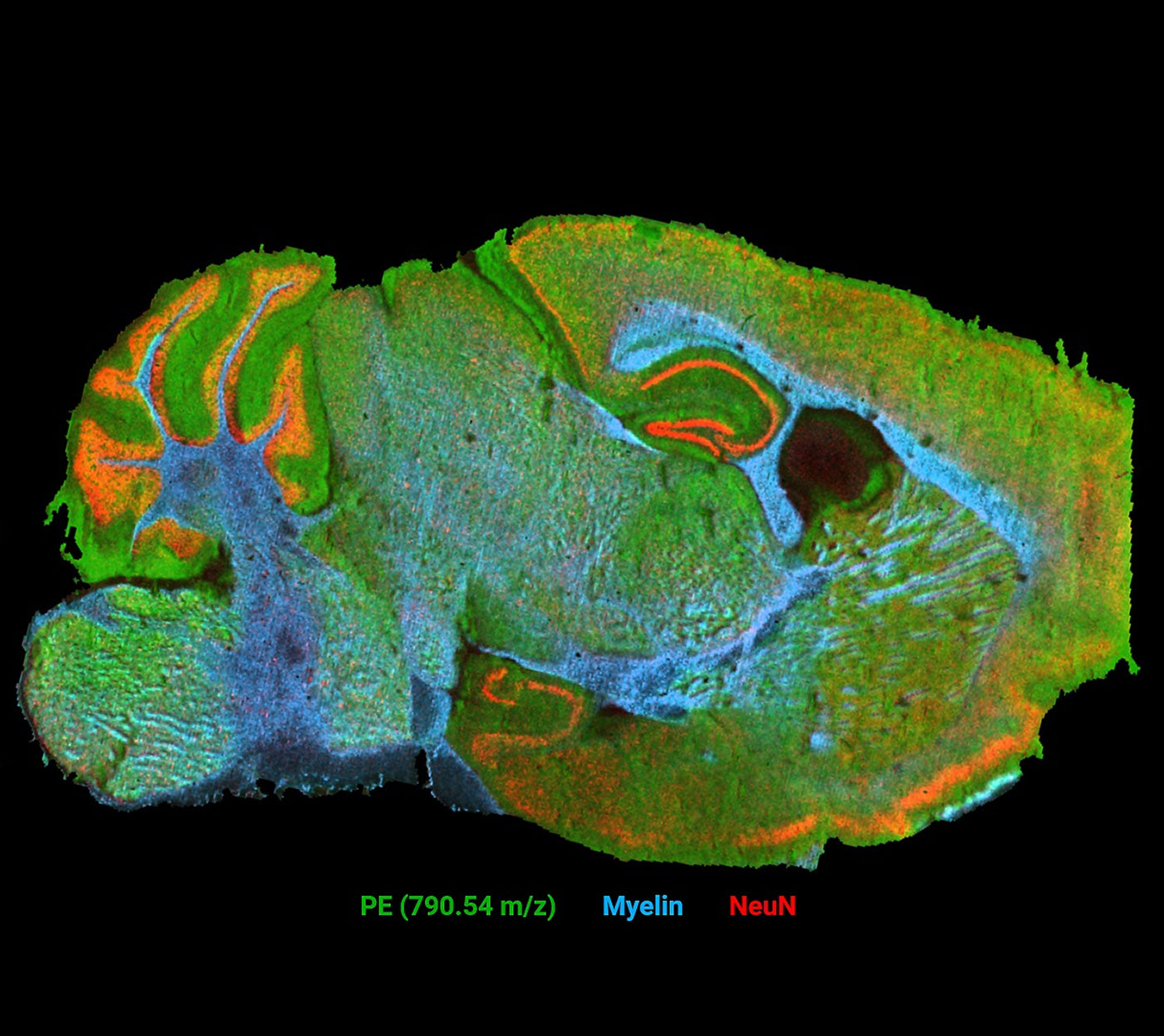 MALDI HiPLEX-IHC imaging