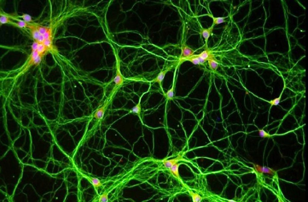 Primary Hippocampal Neurons