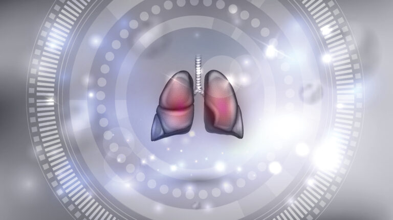 Cystic Fibrosis Foundation Funds Nanoparticle Delivery to Lung