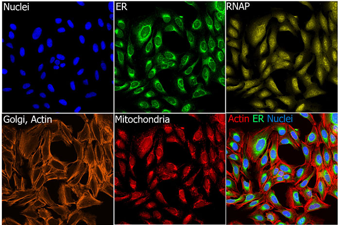 cells stained with dyes in a Cell Painting assay