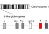 Delta Force: Scientists Promote Novel Globin Genetic Therapy for Sickle Cell Disease