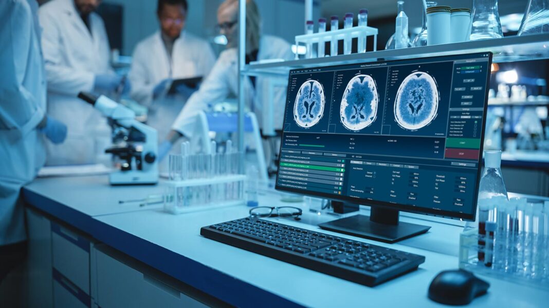 Desktop Computer with Running Software of MRI Brain Analysis