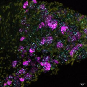 Mouse neurons with the new ion channel Elkin1 (cyan), which is responsible for touch sensation, nucleus (yellow) and the already known ion channel Piezo2 (magenta). 