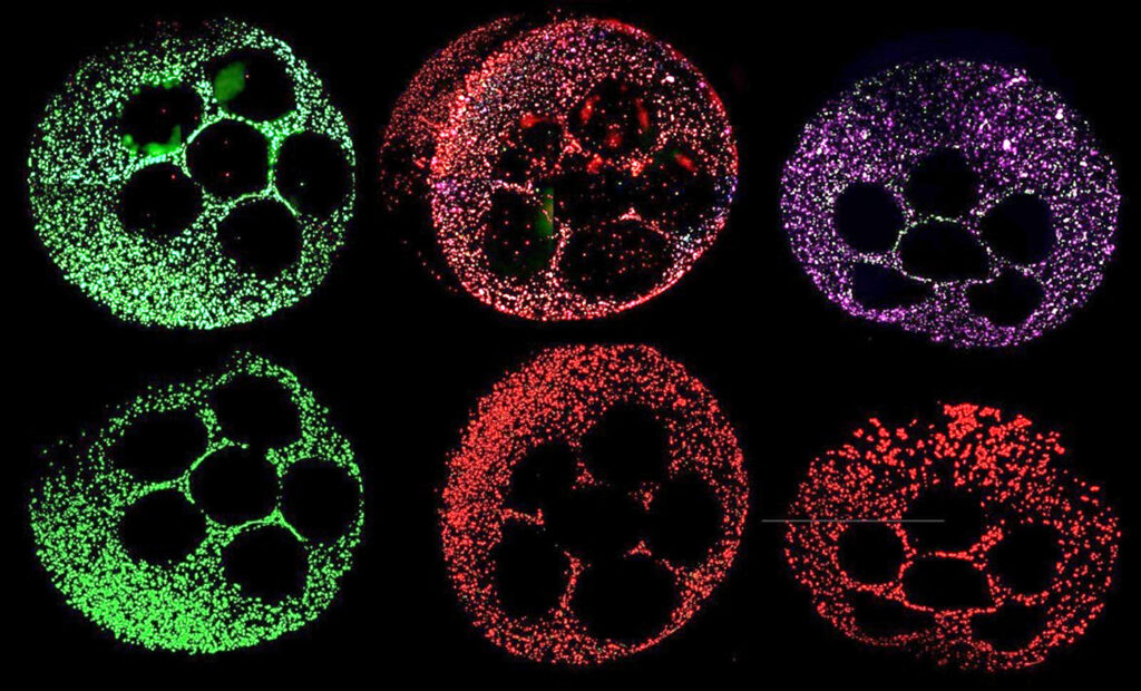 organoids