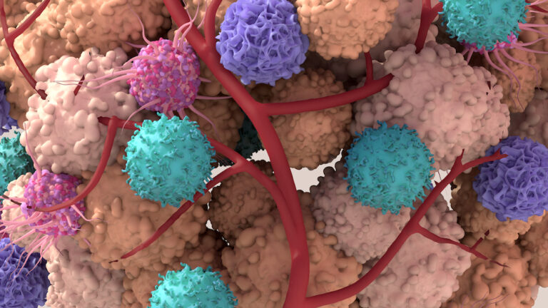 Assembloids Model Patient-Specific Lung Cancers with Tumor Microenvironments