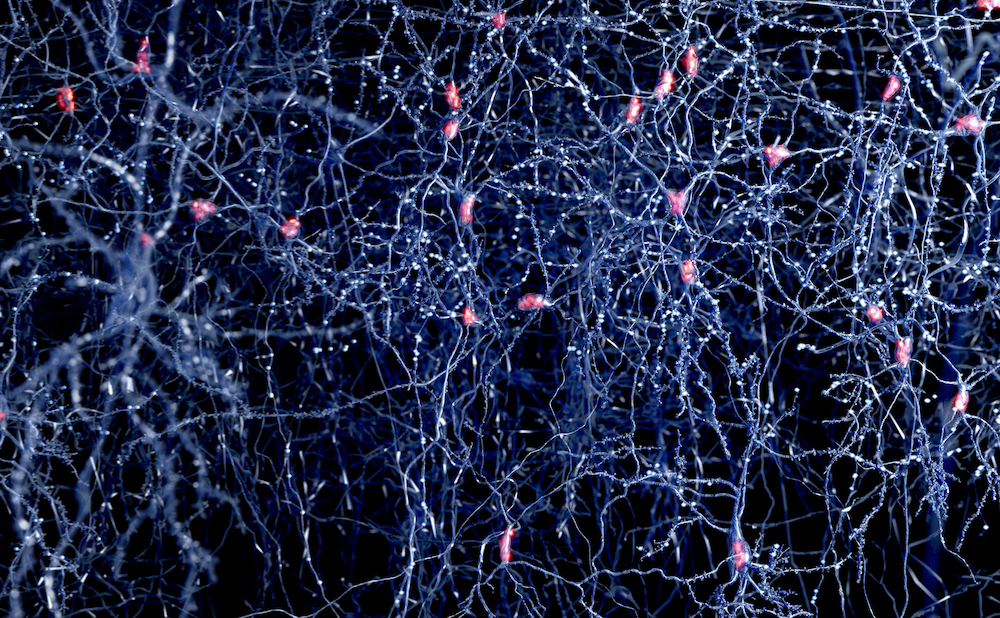 ASO Therapy Repairs Neurons from Timothy Syndrome Patients