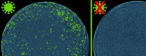 Treatment with Cas13d-NCS prevents the spread of SARS-CoV-2 (green). [Wolfgang Wurst, PhD]