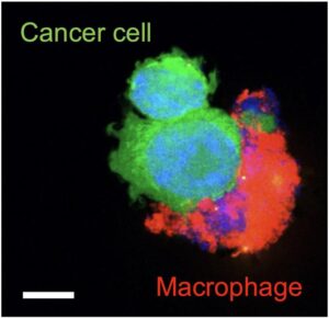 An image showing phagocytosis of a cancer cell by macrophages in the presence of a bispecific antibody conjugated drug-loaded nanotherapeutic