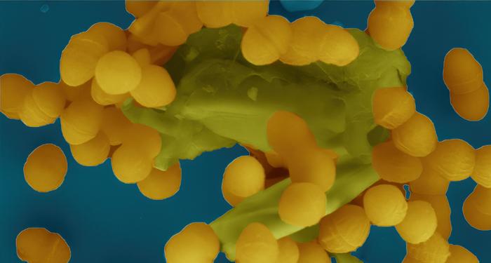 Degradation of Bacterial Cell Wall Key in Spread of Resistance