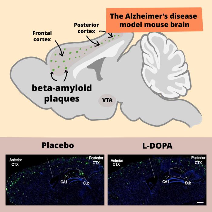 L-DOPA reduces harmful beta-amyloid plaques in AD model mice 