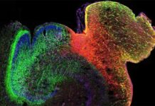 3D Multiomics Adds Depth to Study of Human Brain Development