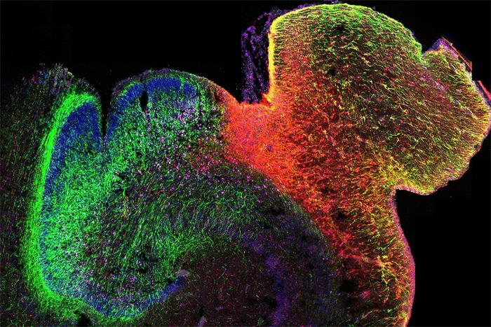 3D Multiomics Adds Depth to Study of Human Brain Development