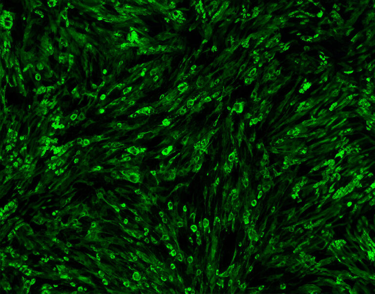 Vaccine Innovations Beyond the Existing mRNA-Based Vaccines for COVID-19