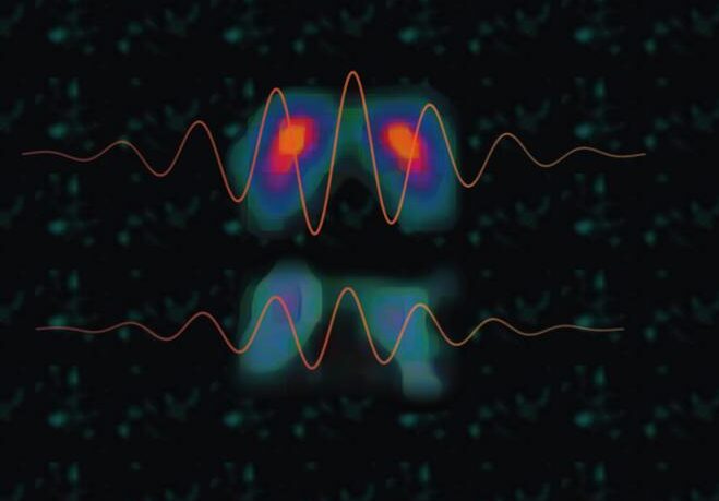 Parkinson’s Symptom, Resting Tremor, Relates to Dopamine in Unexpected Way