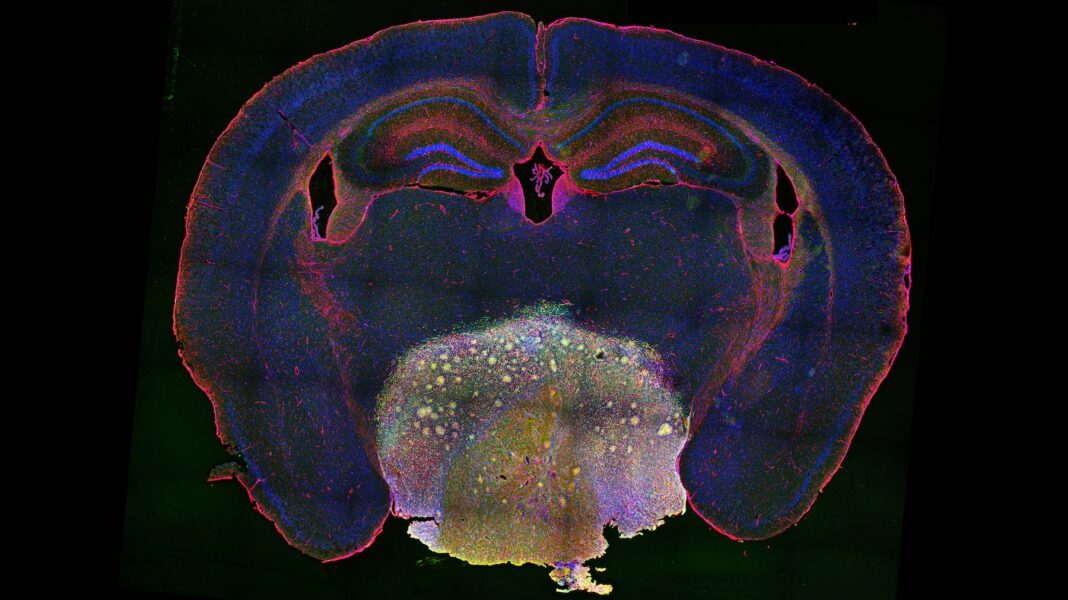 Mouse craniopharyngioma